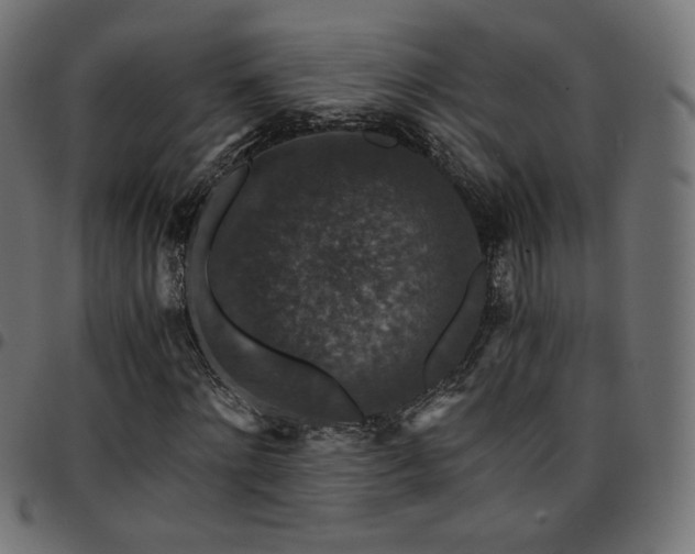 X0000095540868200712141522