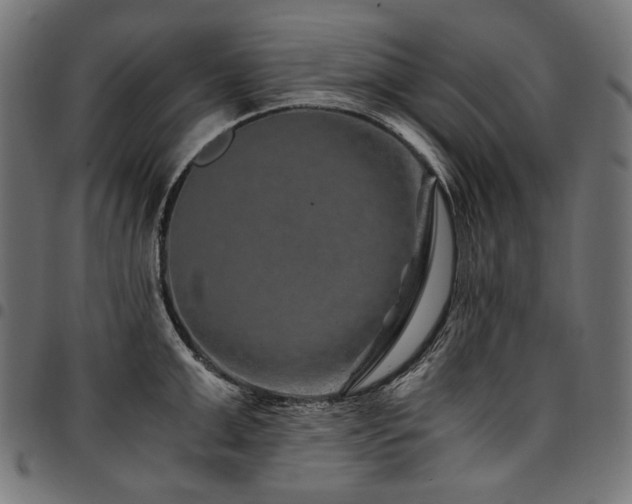 X0000095540999200712141520