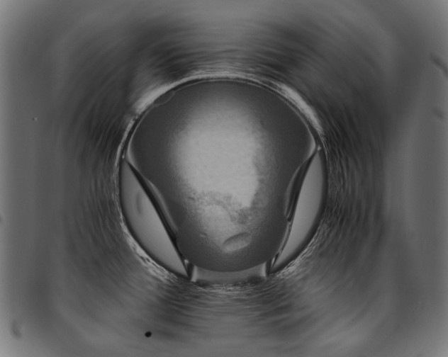X0000095541388200712141514