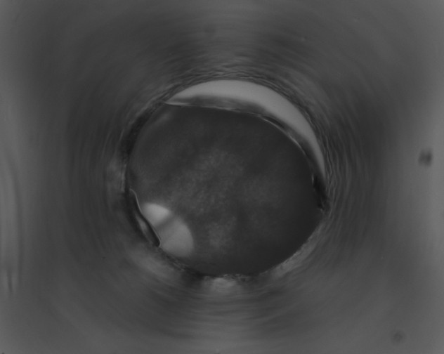 X0000095540180200801041317