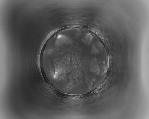 X0000095540147200801111440