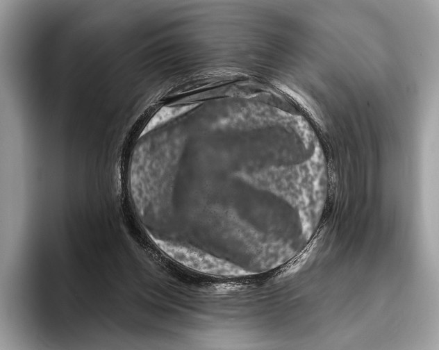 X0000095540158200801111440