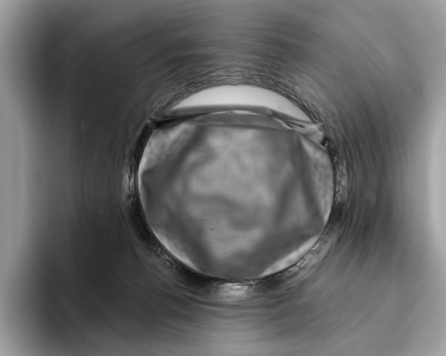 X0000095540176200801111440