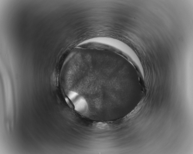 X0000095540180200801111440