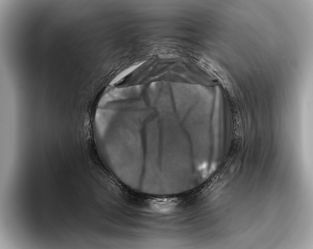 X0000095540465200801111437