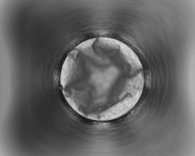 X0000095540476200801111437