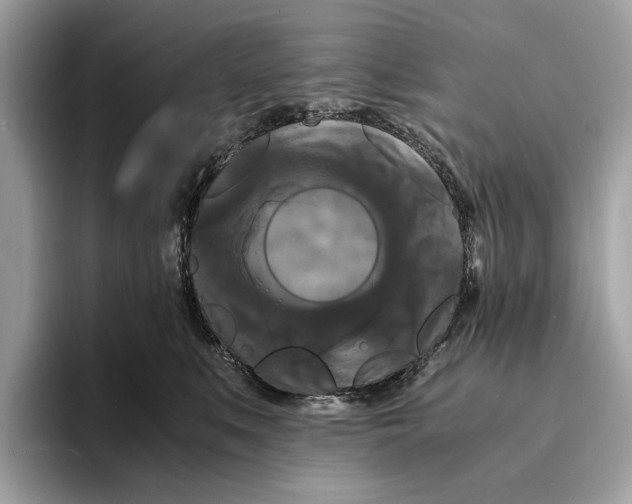 X0000095540519200801111436