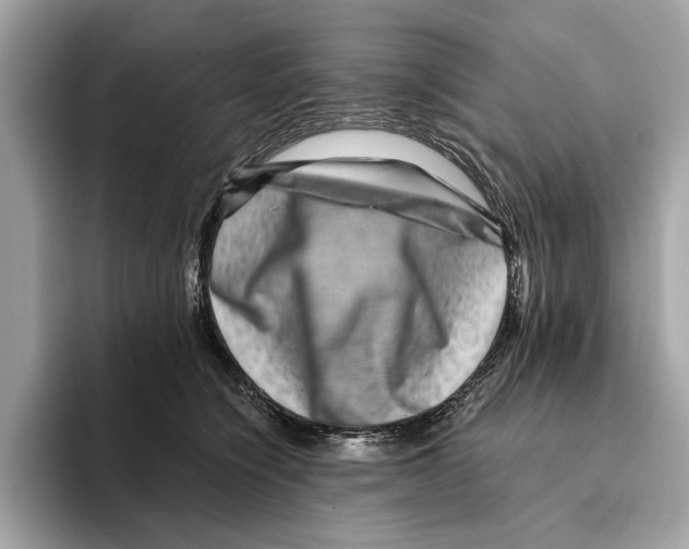 X0000095540564200801111435