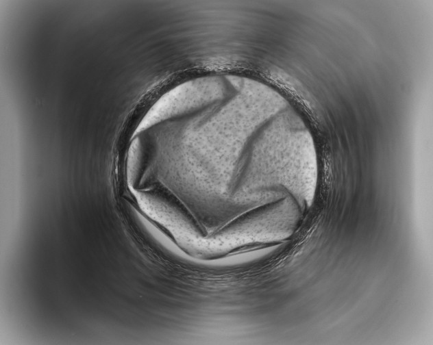 X0000095540592200801111435