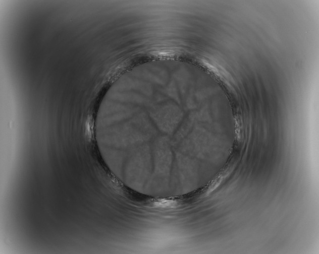 X0000095540718200801111433