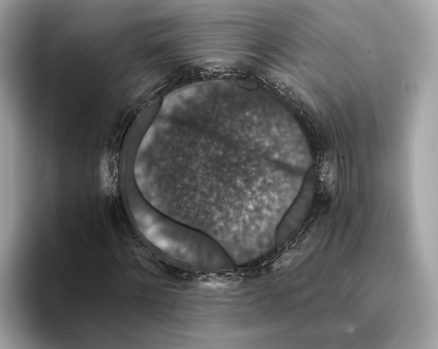 X0000095540868200801111431