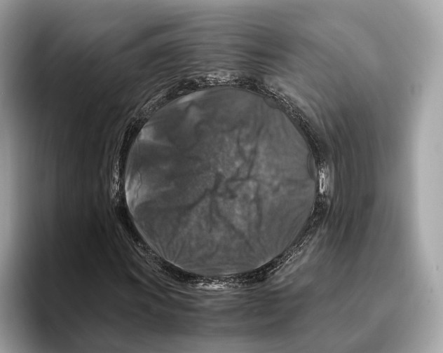 X0000095541011200801111429