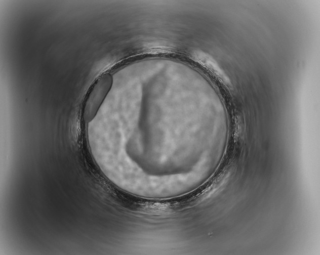 X0000095541261200801111426