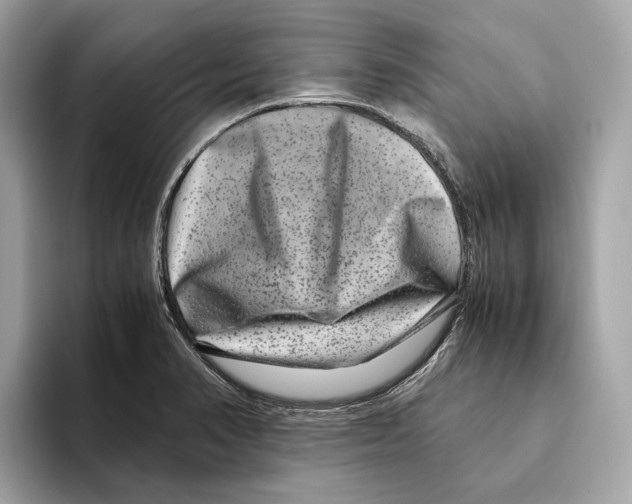 X0000095541374200801111425