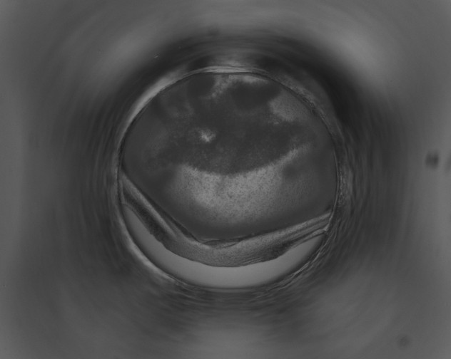 X0000095551487200801041320