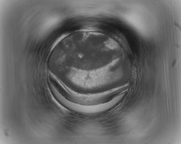 X0000095551487200801111442