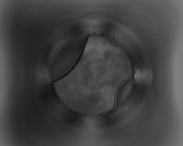 X0000095670819200801081207