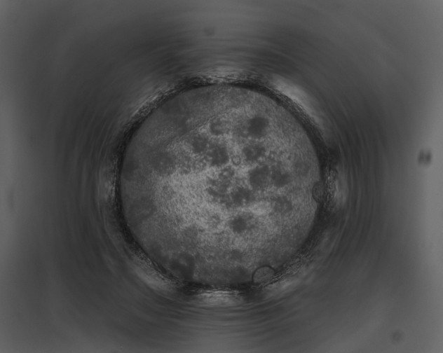 X0000095670499200801151107