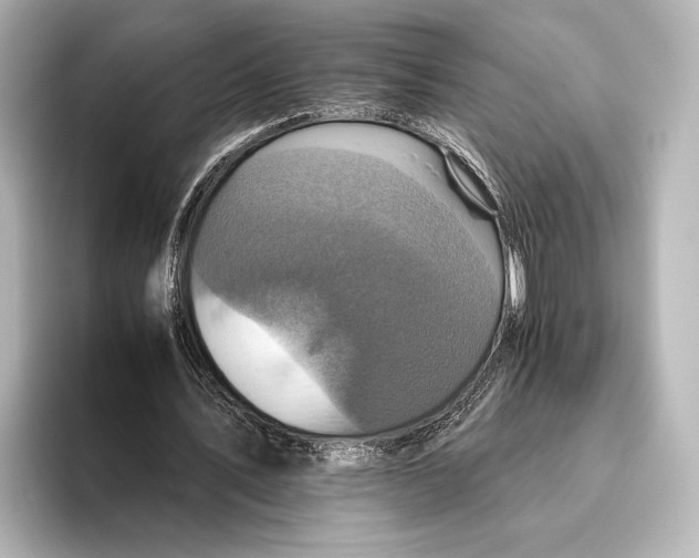 X0000095670579200802051232