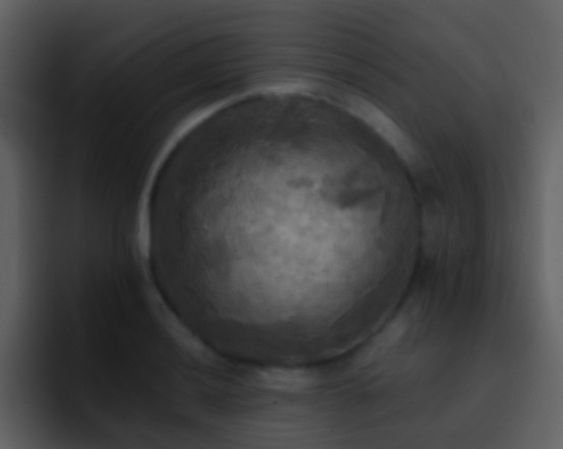 X0000095681036200801081225
