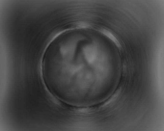 X0000095681047200801081225