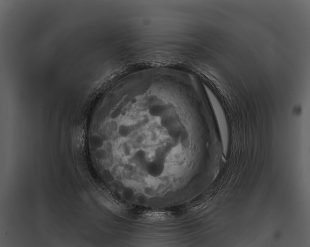 X0000095680499200801151129