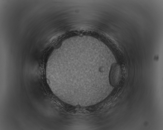 X0000095680918200801151122