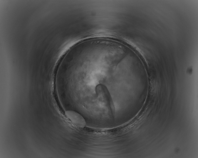 X0000095681415200801151116