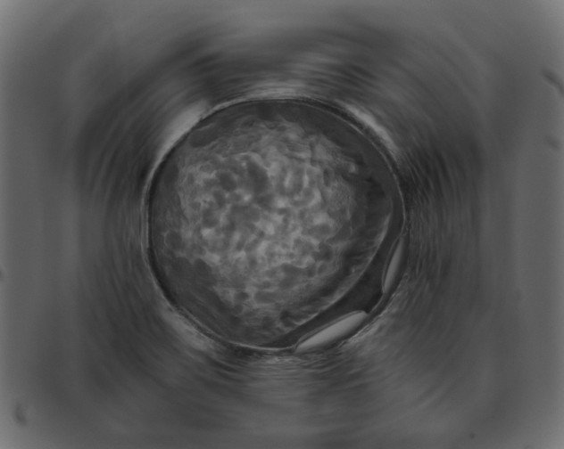 X0000095681467200801221215