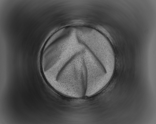 X0000095691475200801291207