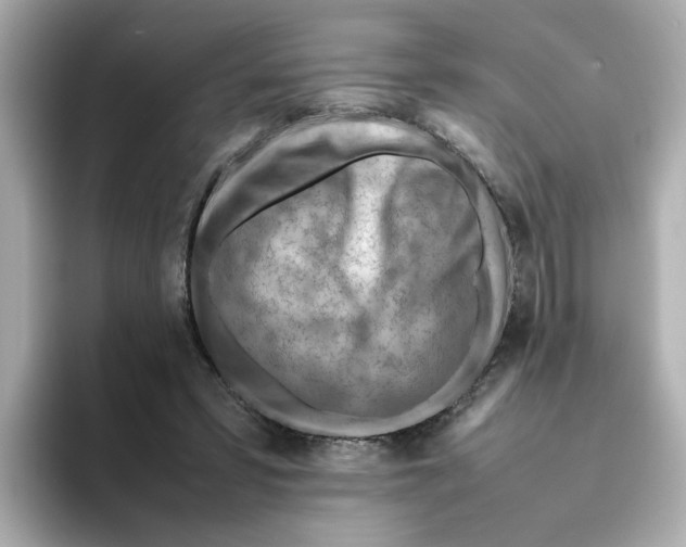 X0000095690399200802051317