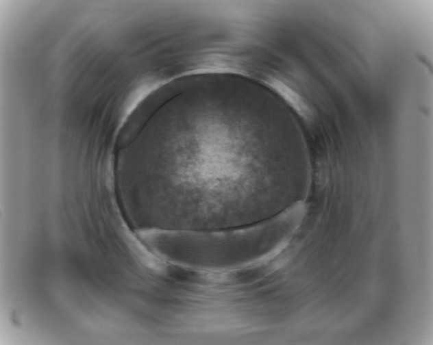 X0000095881468200801111122