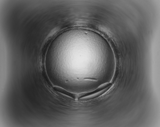 X0000095881403200801181156