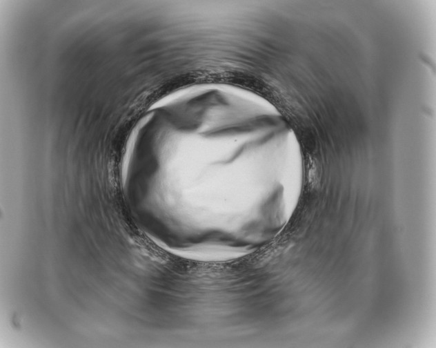 X0000095880819200802011042