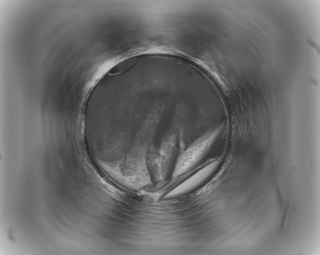 X0000095881367200802011034