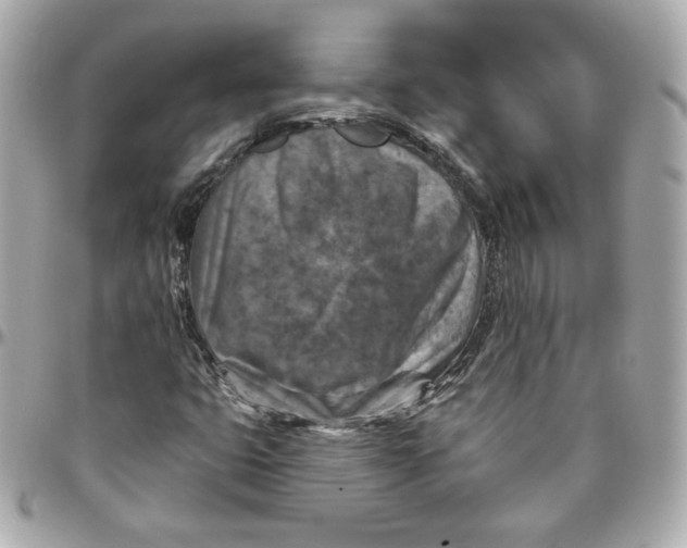 X0000095881399200802011033