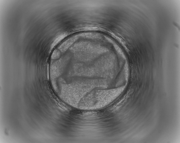 X0000095881171200802081048