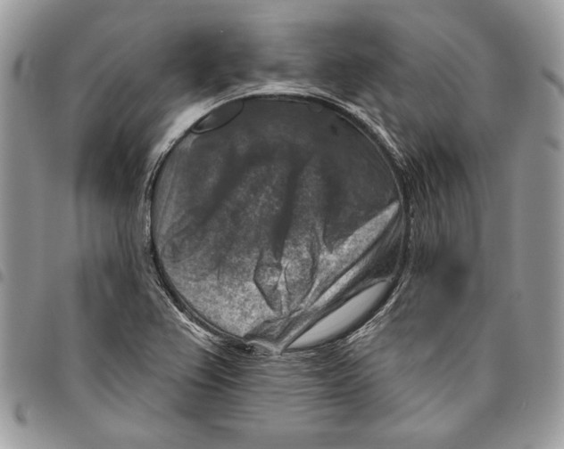 X0000095881367200802081045