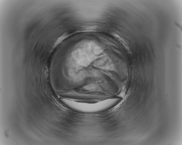 X0000095881449200802081044