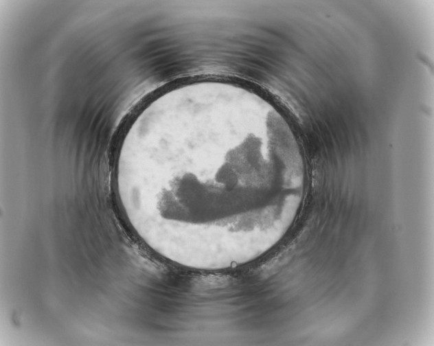 X0000095891117200802011101