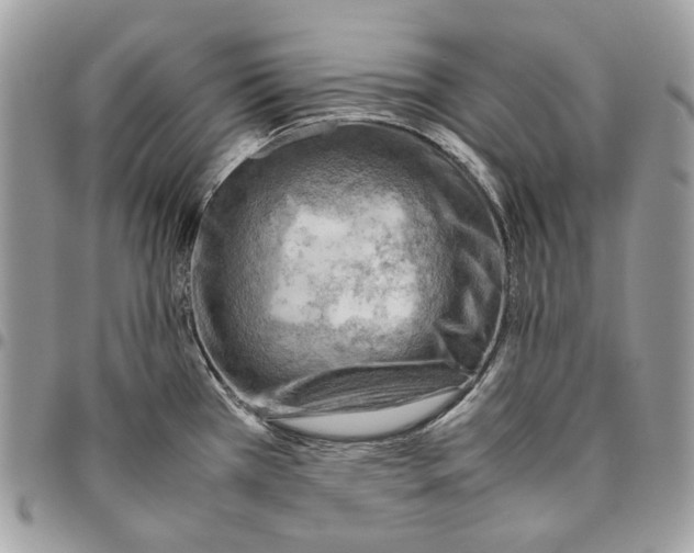 X0000095891385200802081107