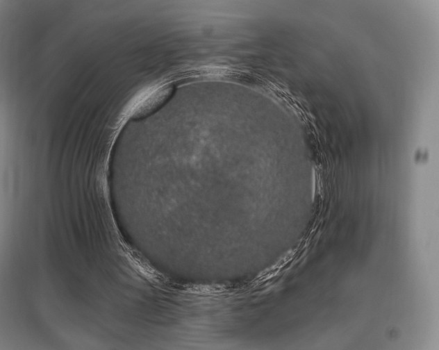 X0000095900147200801111217