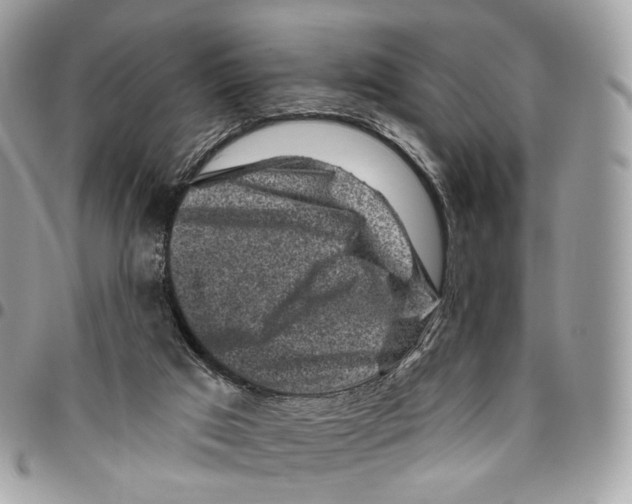 X0000095900017200802081150