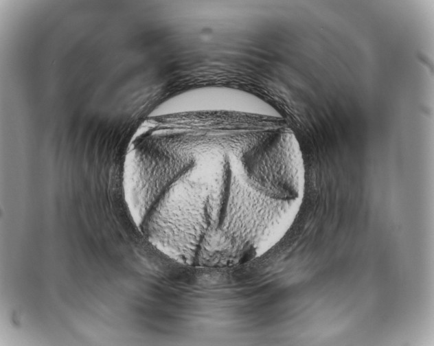 X0000095900177200802081148