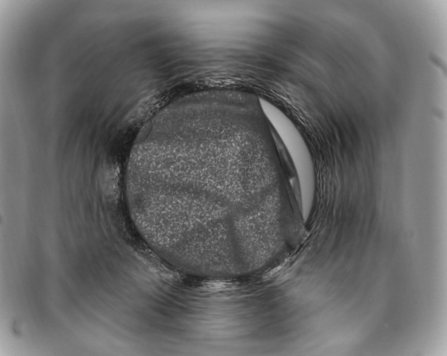 X0000095900319200802081146