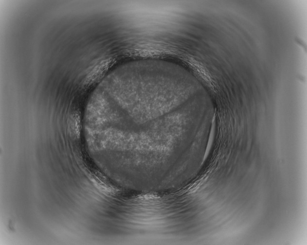 X0000095900644200802081141