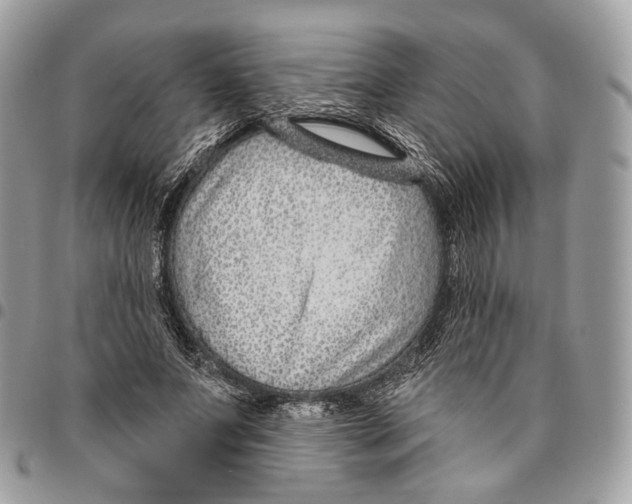 X0000095900687200802081140