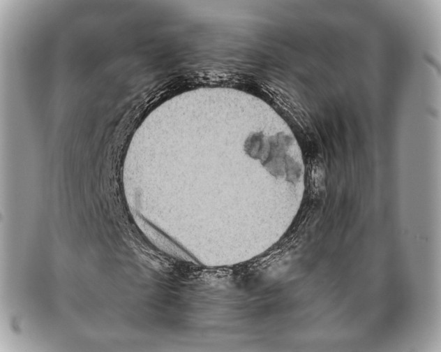 X0000095900865200802081138