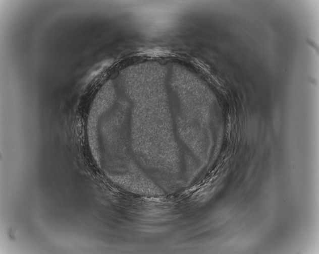 X0000095901398200802081129