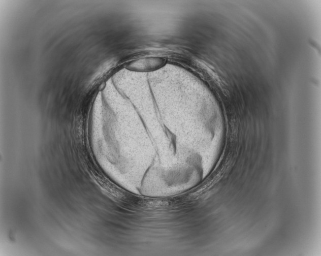 X0000095901403200802081129